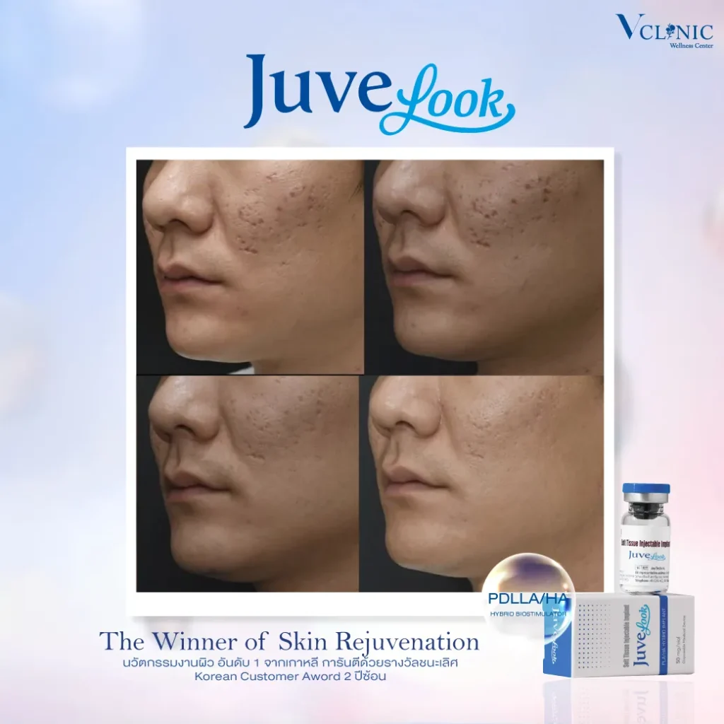 20(1)z-z1138865145844