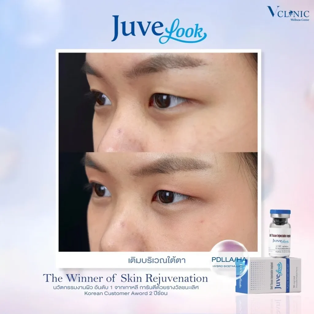 LINEALBUMJuvelook๒๔๐๒๑๕1z-z887696240148