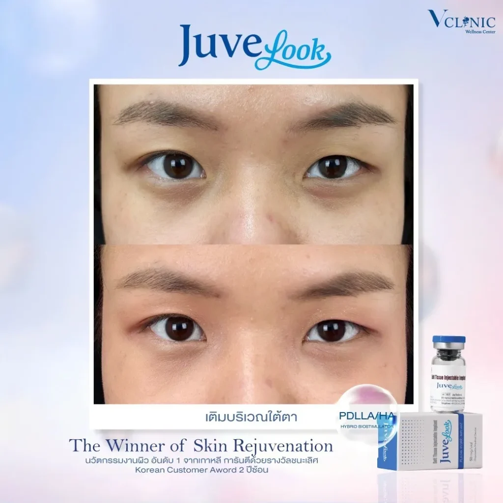 LINEALBUMJuvelook๒๔๐๒๑๕2z-z527953743944