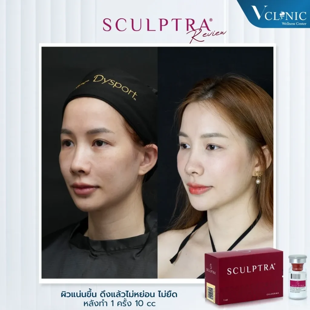 LINEALBUMSculptra๒๓๐๖๒๒2z-z1199405177888