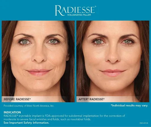 raduessebaz-z1081544053772